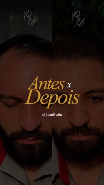 A melhor transformação que você vai ver hoje é real, sem filtro e sem exagero. Quer alcançar a sua t