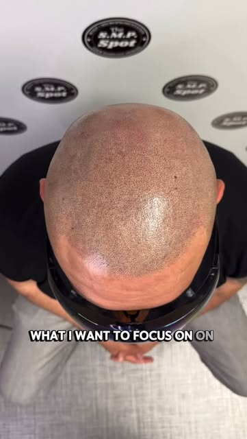 Bakersfield! Hairlines require a lot more detail and varied technique to get that natural, subtle, b