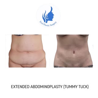✨💫 𝗙𝗥𝗢𝗠 𝗠𝗔𝗦𝗦𝗜𝗩𝗘 𝗪𝗘𝗜𝗚𝗛𝗧 𝗟𝗢𝗦𝗦 𝗧𝗢 𝗔 𝗖𝗢𝗡𝗧𝗢𝗨𝗥𝗘𝗗, 𝗖𝗢𝗡𝗙𝗜𝗗𝗘𝗡𝗧 𝗡�