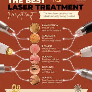 There's no such thing as "the best laser" - pigmentation, acne scars, redness, rosacea, fine lines, 