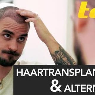 https://www.youtube.com/watch?v=E1EIlJ-5R-U
Link in der Bio 
Hollywood Stars und Ihr Haarproblem. Si