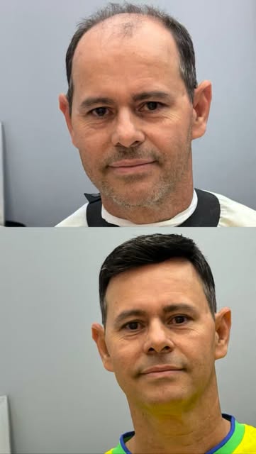 Aos 30 anos, ele começou a conviver com a calvície. Aos 54, decidiu que era hora de mudar. 👊

Foram