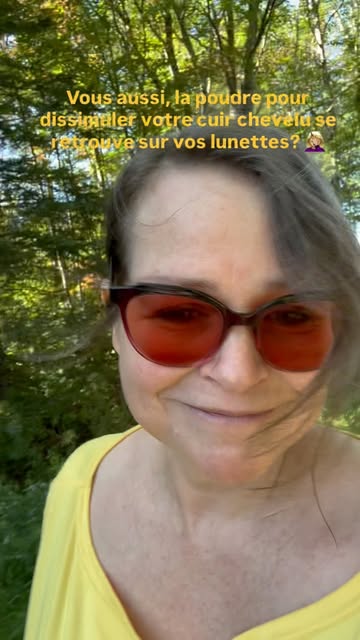 #micropimentationcapillaire #cheveuxclairsemés #pertecheveux #scalpmicropigmentation #apoint