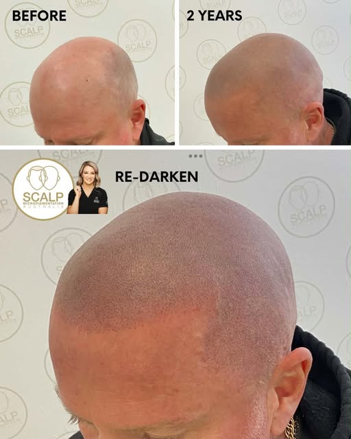 A nice re-darkening session for this guy, so nice catching up with our clients over the years! 

#sm