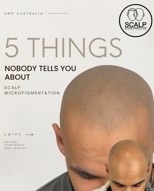 Thinking about Scalp Micropigmentation? Here are 5 things you should know before you book.

The heal