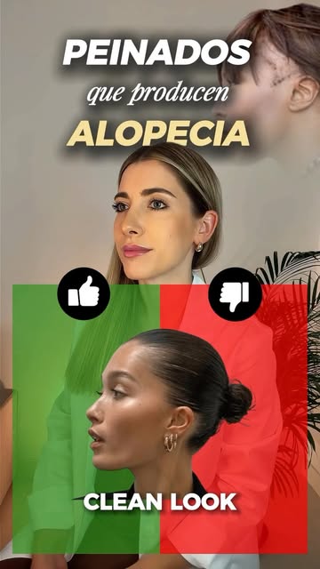 🚨 ¿Sabías que algunos peinados pueden provocar alopecia? 

🎀 Coletas
💇🏻‍♀️ Moños
🪢 Trenzas
…cua