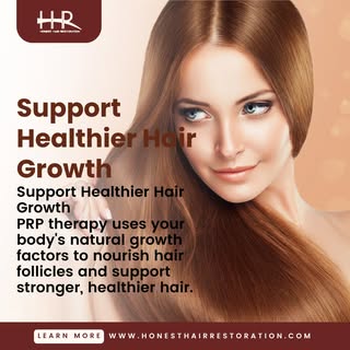 PRP (Platelet-Rich Plasma) therapy uses your body's own concentrated growth factors to help support 