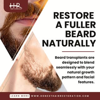 A fuller, natural-looking beard starts with a personalized approach.

Using advanced FUE (Follicular