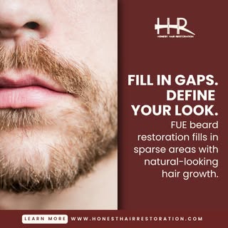 Thinning hair doesn't have to define your look.
At Honest Hair Restoration, Dr. Maag and his team us