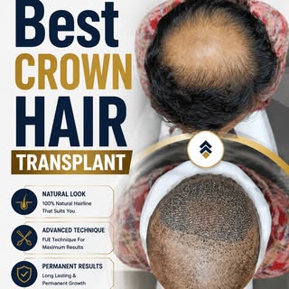 Best Crown Hair Transplant 👑 | Restore Your Crown Naturally

A fuller crown. A natural look. A conf