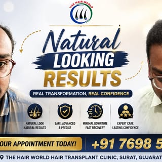 🔥 Natural Looking Results – Real Hair, Real Confidence! 🔥

Hair transplant પછી માત્ર વાળ જ નહીં, c