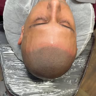 #smp #sma #sd #scalpmicropigmentation #sekolah #hairloss #hairtattoo #scalptattoo #ppdb #smk #microp