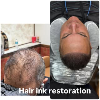 scalpmicropigmentation #smp #hairloss #hairtattoo #scalptattoo #hairlosstreatment #hairlosssolution 