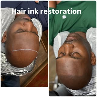 @ hairinkrestorationscalpmicropigmentation #smp #hairloss #hairtattoo #scalptattoo #hairlosstreatmen