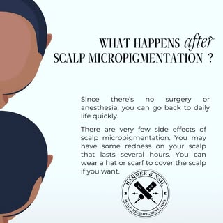 Tip Tuesday! #baldcure #scalptattoo #northhavenct #alopicia #headtattoo #smp #scalpmicropigmentation