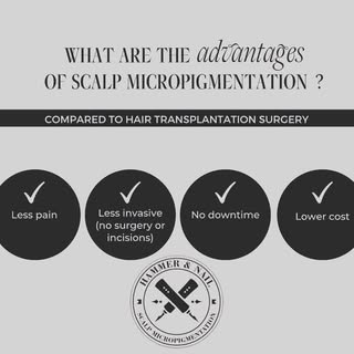 Tip Tuesday!  Advantages of Scalp Micropigmentation. #hairtattoo #scalptattoo #smp #scalpmicropigmen