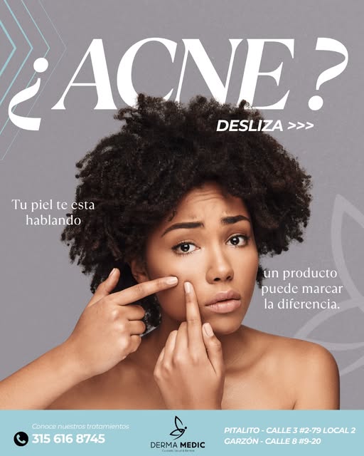 💙 ¿Acné? Tu piel te está hablando.

El acné no siempre se trata de “un granito más”. 🫣 Detrás de e