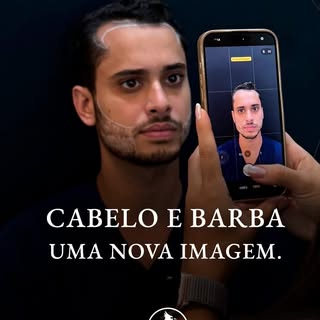 Cabelo e barba: uma transformação completa! 

Mateus convivia com a calvície desde os 18 anos.

Ele 