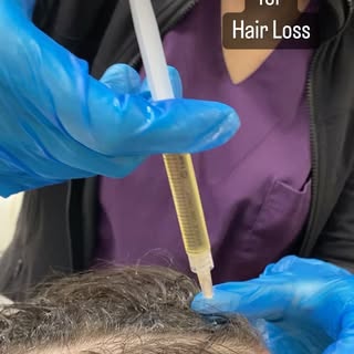 PRP-Platelet Rich Plasma is an excellent way to stimulate hair growth! 
This is a young female patie