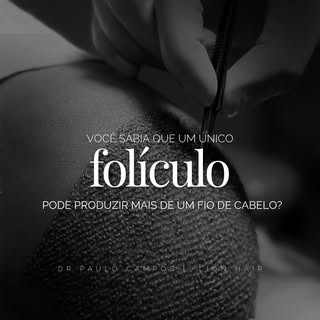 Você sabia que uma única unidade folicular pode conter mais de um fio?

- Esse é um dos detalhes que