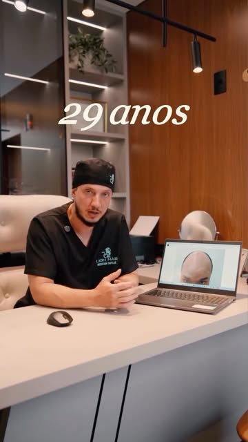 Aos 29 anos, a perda de cabelo já fazia parte da rotina deste paciente, e também da forma como ele s