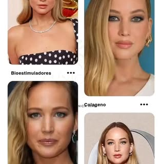 ¿Sabías que Jennifer Lawrence y otras estrellas confían en este increíble tratamiento para mantener 