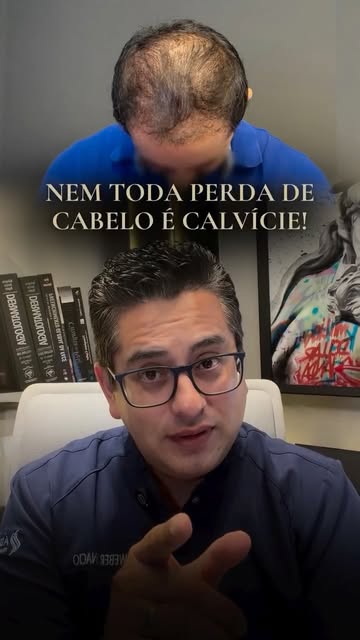 Nem toda falha no cabelo é calvície. 👨🏼‍🦲

Existem diferentes condições do couro cabeludo que tam