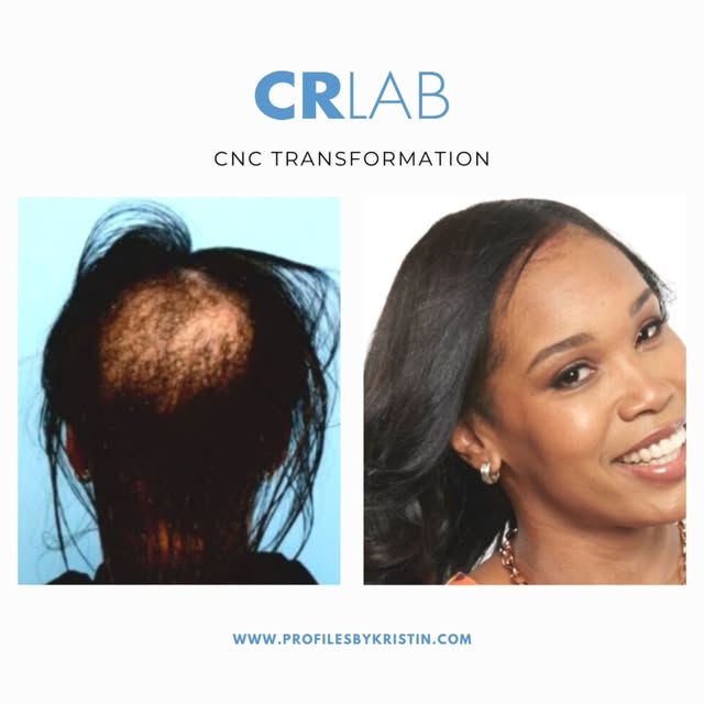 Book a free consult with us to find what solutions works best for your hair loss needs today!

📍 Pr