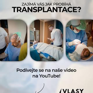 🧑‍⚕️ Jak vlastně probíhá transplantace vlasů?

Pokud vás zajímá celý proces od první konzultace až 