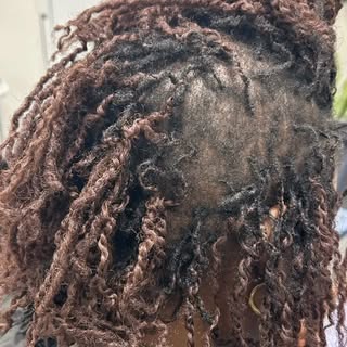 There’s something incredibly rewarding about seeing a client’s progress unfold; the healthier scalp,