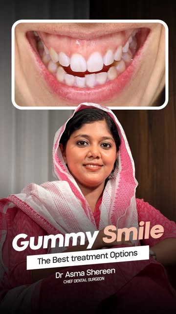 Do you have gummy smile?