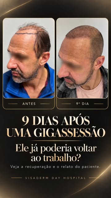 Grandes casos não começam com grandes números. Começam com um grande planejamento.

Este paciente ap