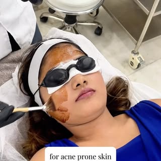 Chemical peel done by @skinfollixclinic and AIIMS NEW DELHI MD DERMATOLOGIST @dr_vijay_soyal 🧴🦋

#