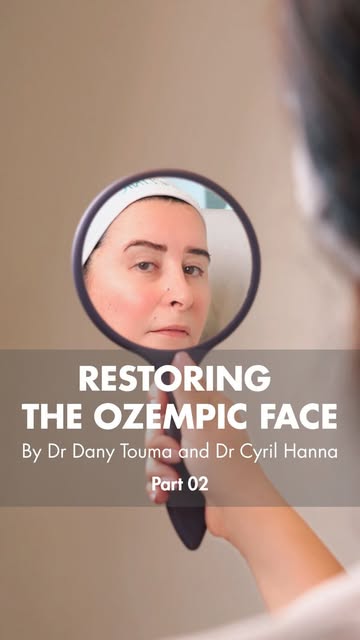 Nadine presented to Dr Touma asking to ‘recuperate’ her normal younger face that looked older after 