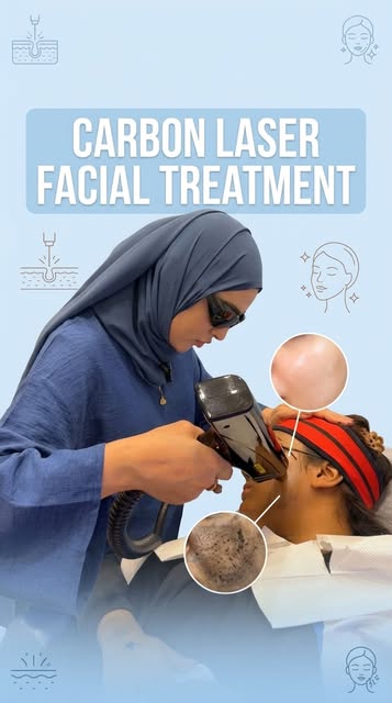 ✨ Refresh Your Skin with a Carbon Laser Facial
Designed to help deep-clean pores, reduce excess oil,