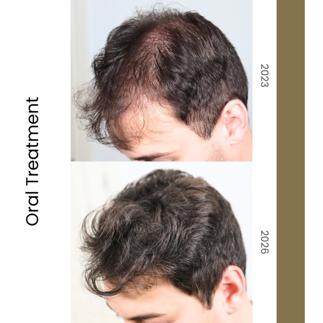 We would like to sincerely thank our patient for the trust he has placed in Instituto Médico del Pra