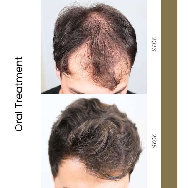We would like to sincerely thank our patient for the trust he has placed in Instituto Médico del Pra