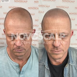 KEEPING IT (LOOKING) REAL is the outcome of every scalp micropigmentation treatment we do.  Since 20