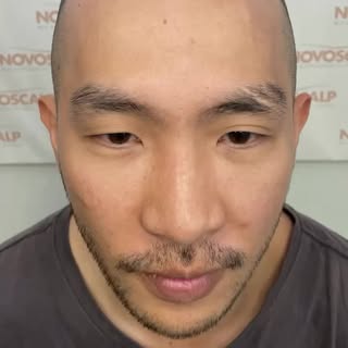 WE'VE GOT CREATING A HAIR TATTOO DOWN TO A FINE ART!⁠
A Scalp Micropigmentation (SMP) treatment will