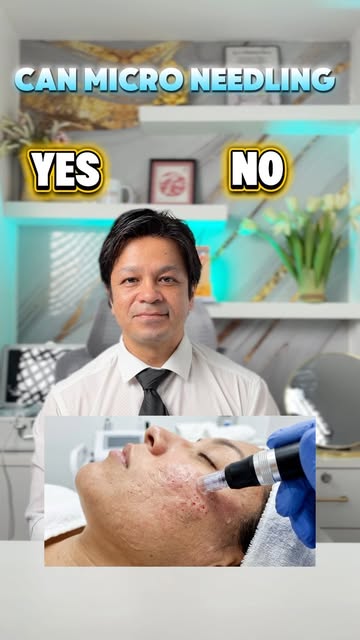 Microneedling: YES or NO? 👀
We put Dr. Rajan to the quick test! 🩺
How many answers did you get rig