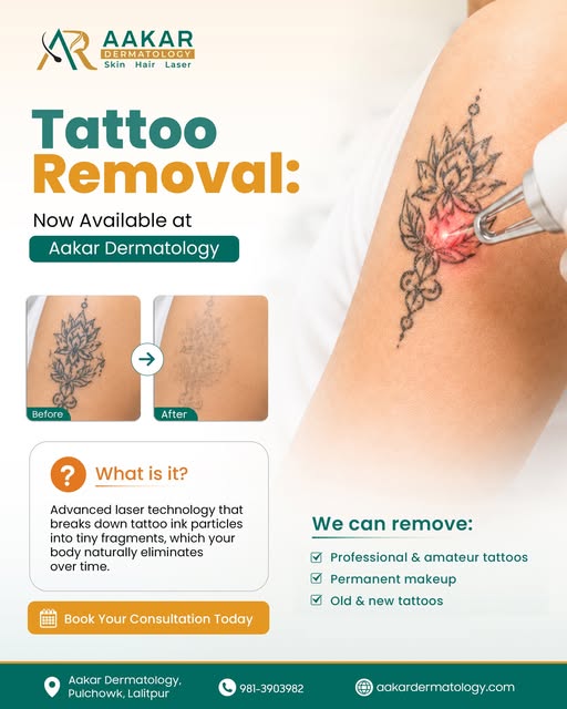 Ready to let go of ink that no longer fits your story? 

Our advanced laser tattoo removal breaks do