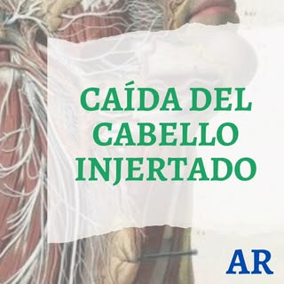 🎬 VIDEO Nº 2
de una secuencia en la cual explicamos el proceso de
- CICATRIZACIÓN
👉 CAÍDA DEL CABE