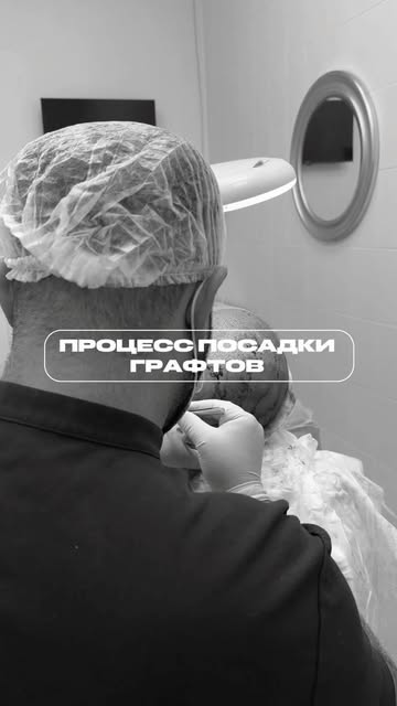 Посадка графтов — это не только про густоту, но и про естественный результат🙌🏼

Мы бережно работае