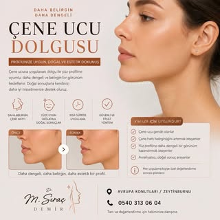 ✨ Daha belirgin, daha dengeli bir profil…

Çene ucu dolgusu; uygun kişilerde yüz profilinin dengelen