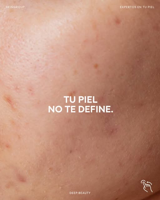 El acné puede ser parte de tu piel, pero nunca define quién eres.
Cuidarla también es aprender a ver