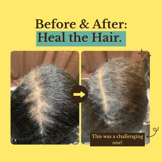 She was very concerned if her hair would grow back. To be honest, this one I wasn't sure. I knew I c