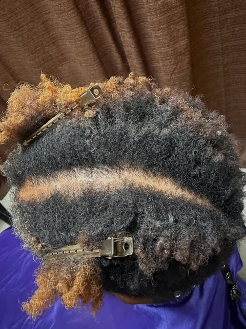 She is about to start my Heal the Hair. Program. 

3 easy tips to reduce inflammation 

1. Take circ