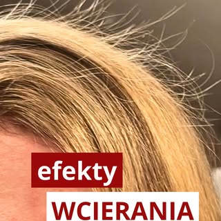 To nie był efekt „po jednym razie”.
To efekt regularności.

Wcieranie działa wtedy, kiedy jest syste