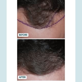 Before ✨ After.  This is the kind of result that comes from 20+ years of expertise and a personalise