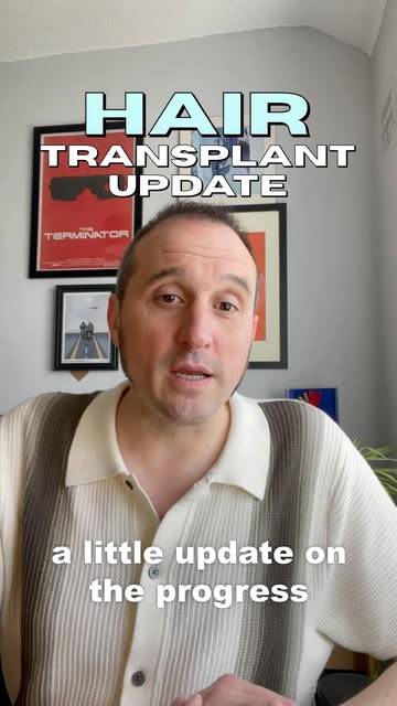 Just a quick update on the progress of my hair transplant. Lots to show and discuss and run my finge